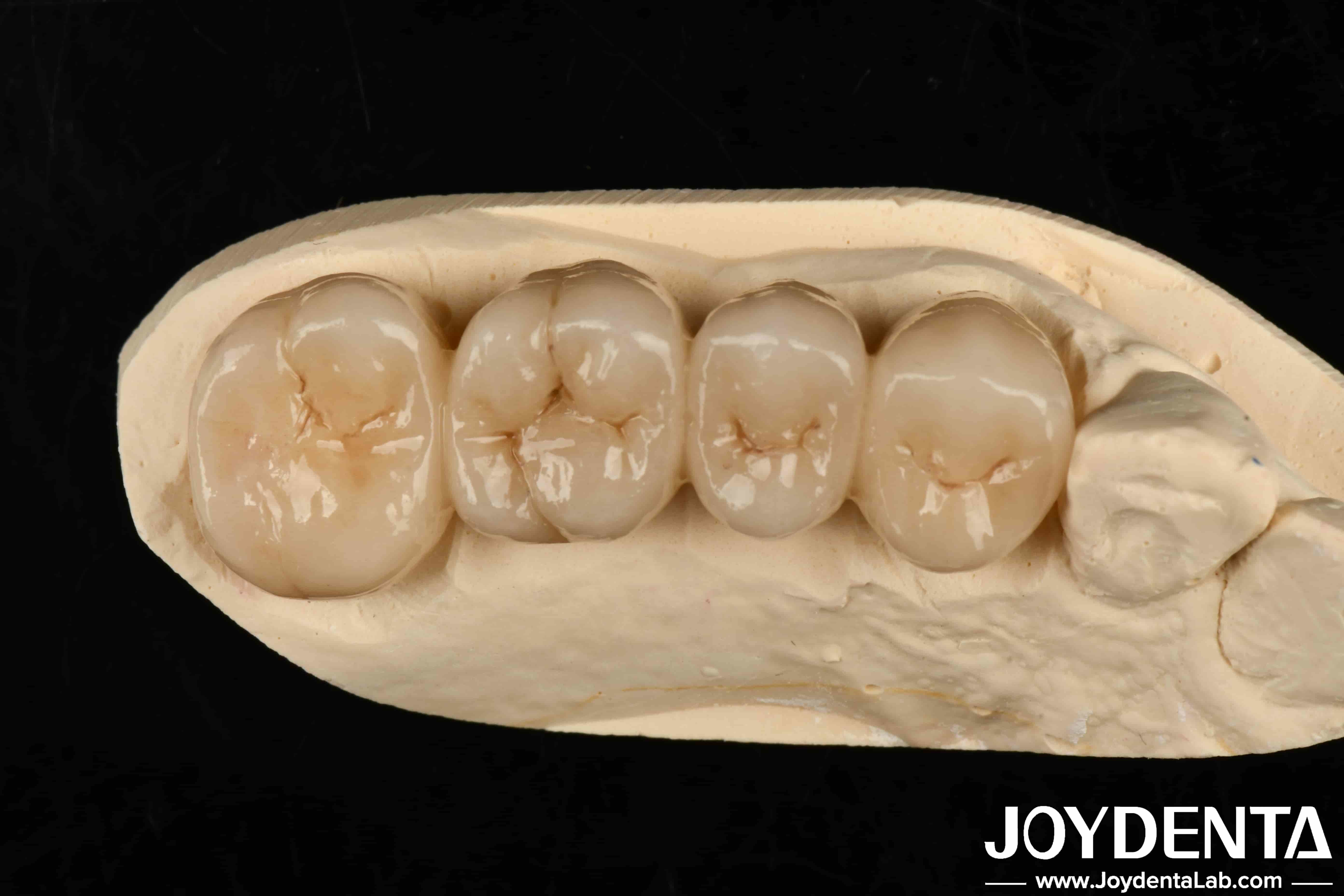 Multilayer Full Zirconia White Style With Layers High Translucency High