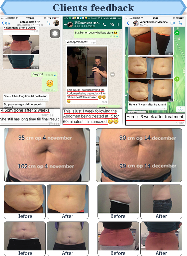 2018 China Popular CE Approved New Cryo 4 Therapy Heads Cool Cryolipolysis Machine