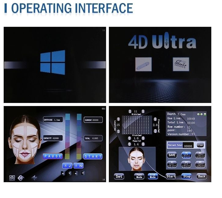 Vmax Ultrasound HIFU Lifting Machine 60000 Shots 4 Cartridges Anti Aging