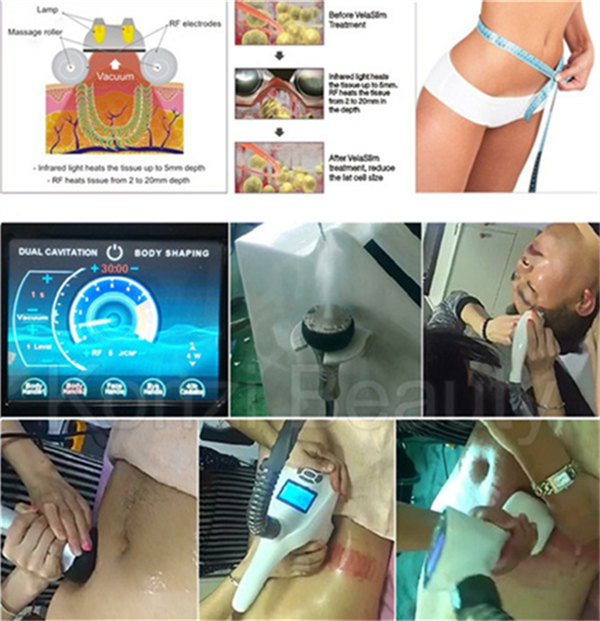 CE Cavitation Body Slimming Machine
