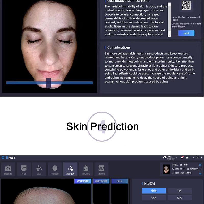 80w Power Intelligent Lasertell Skin Analysis System