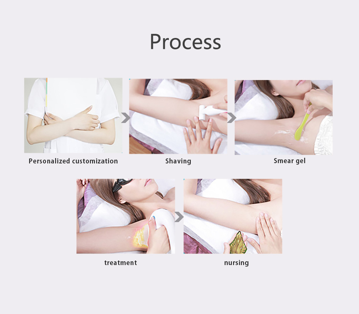 CE 600W 1000W Diode Laser Hair Removal Device Portable
