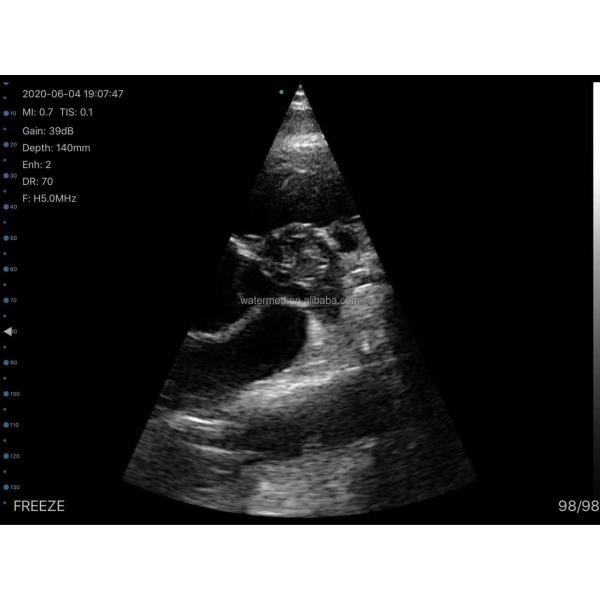 Linear/Convex/Phased Array 3 in 1 Handheld USB Ultrasound Double Probes Wireless Color Doppler Scanner