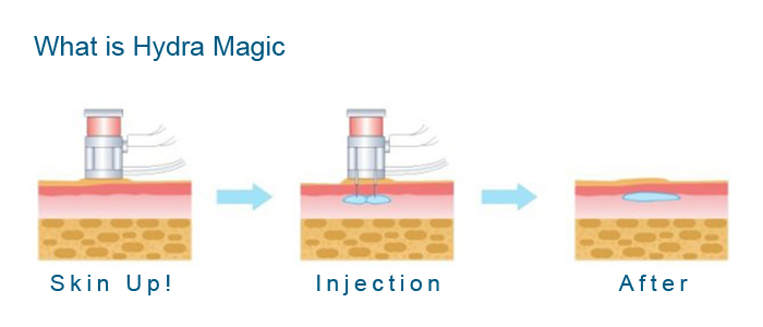 ADSS New Designed Skin Care Mesotherapy Hydro Lifting Mesogun Injector