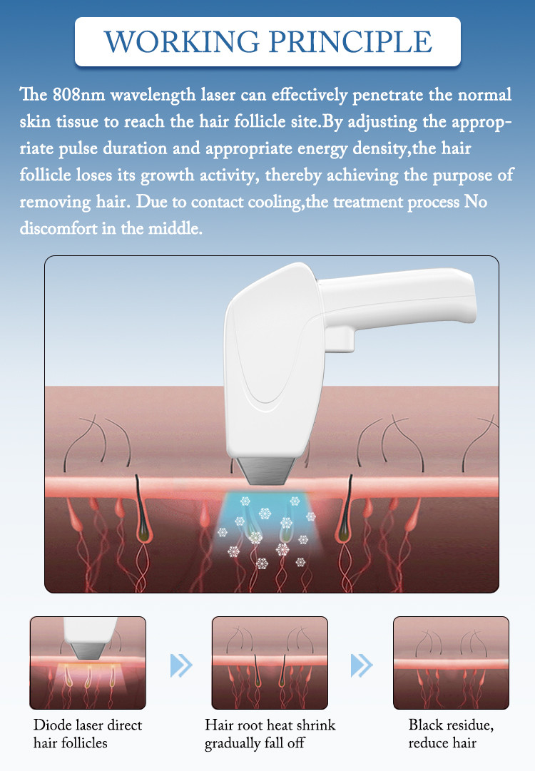 Fda Approved Advanced Vertical White Color Lightsheer Diode Laser Hair Removal Machine 808nm