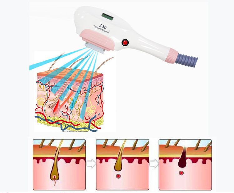 Skin Tightening Optical Ipl Hair Removal Machine 610nm Multi Pulse