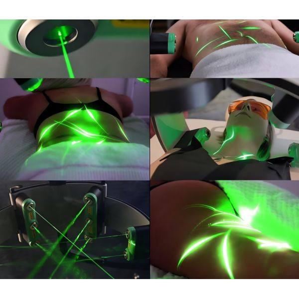 10D Dual Wavelength Body Slimming Laser Machine 500W For Body Shape