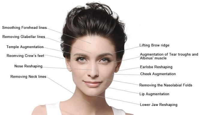 Neuramis Deep Shape Korea Original 1ml Hyaluron Ic Acid Deep Dermal Filler