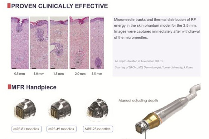 CE approved Nubway high quality 2018 fractional rf microneedle face treatment fractional rf microneedle machine for sale