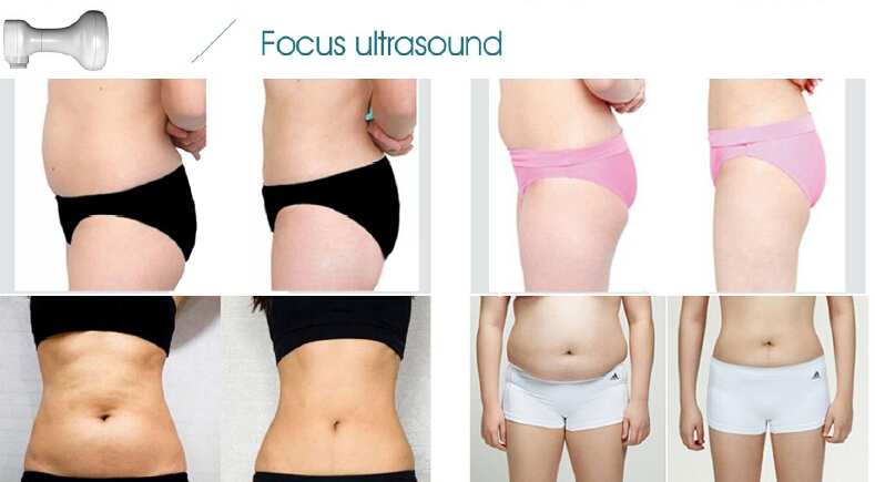 *New product looking for distributor! Hifu slimming machine