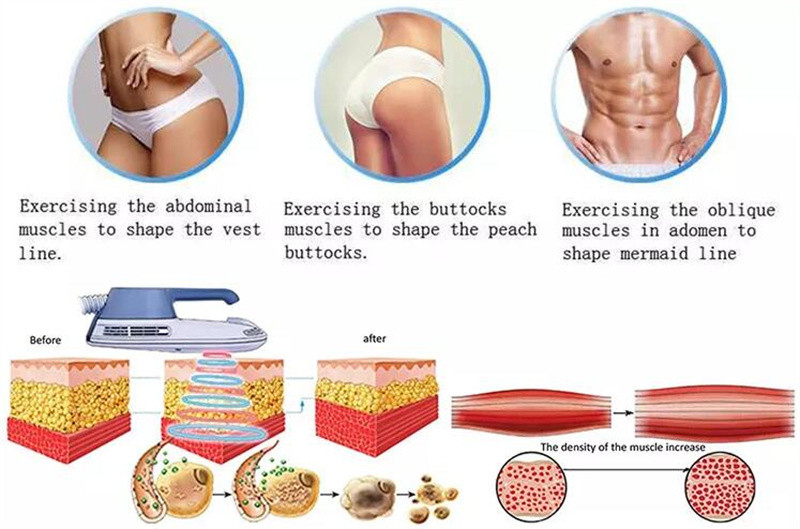 Zohonice Sculpting Electo Magenetic Body Slimmingting Machine Pelvic Floor Recovery Slimming Body Sculpting