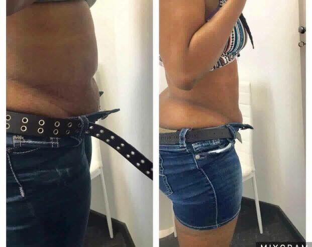 4-5cm fat lost after 1 treatment wind+water+semiconductor cooling system cryotherapy slimming machine