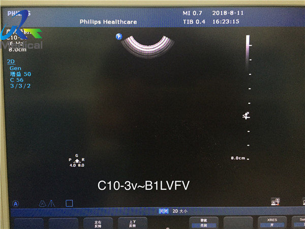 EPIQ C10-3V Endovaginal Ultrasound Transducer/Supersonic Device