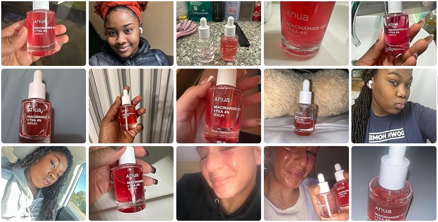 10% Niacinamide+ 4% Tranexamic Acid Hyperpigmentation Serum For Sensitive Skin Dark Spot Correcting 30ml