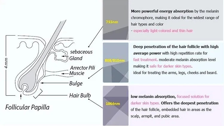 808nm Diode Hair Removal machine Soprano Ice Platinum Big Screen 1800W Yag Laser Depilation