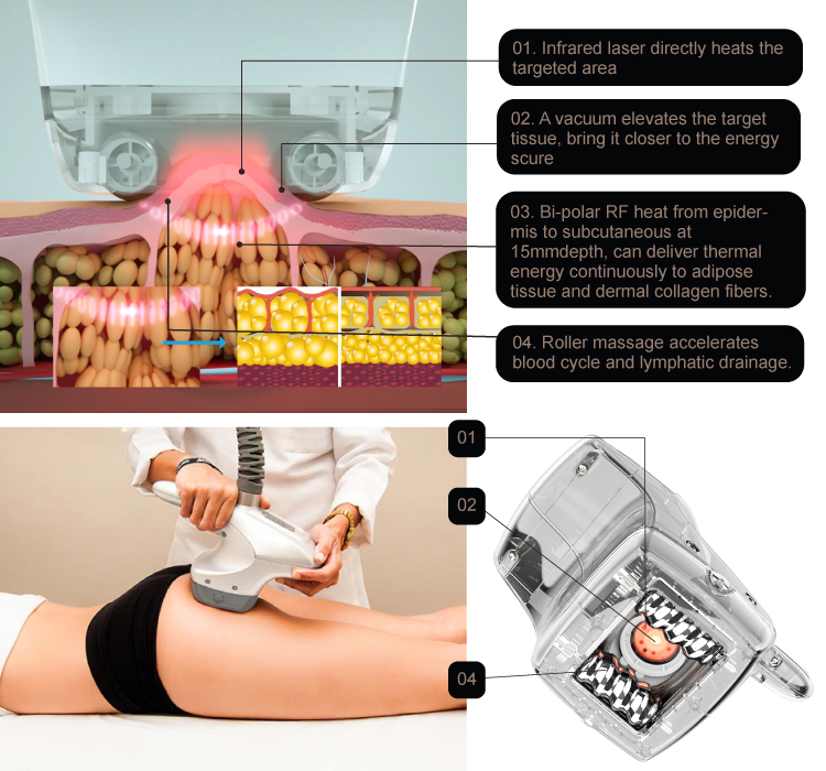 RF Slimming Machine 4 Roller Heads Cavitation Vacuum Body Massage