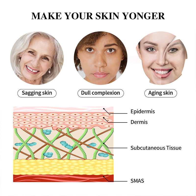 Rf Beauty Equipment For Face Household Beauty Skin Care And Freckle Radio Frequency Beauty Instrument