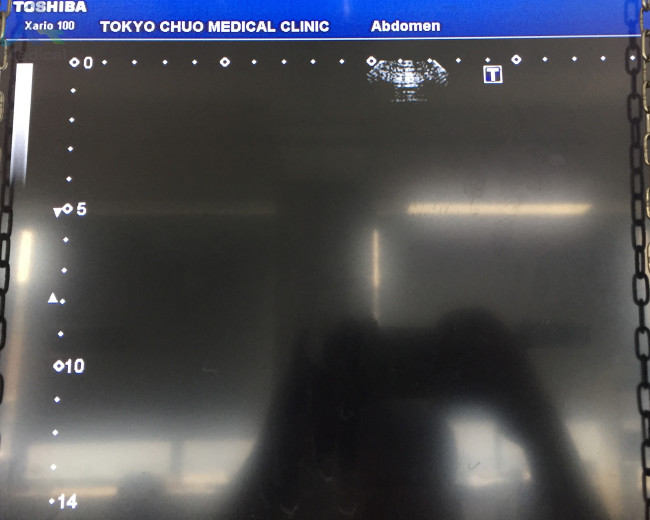Toshiba PST-25ST Cardiac Sector Ultrasound Probe Diagnosis Spare Parts