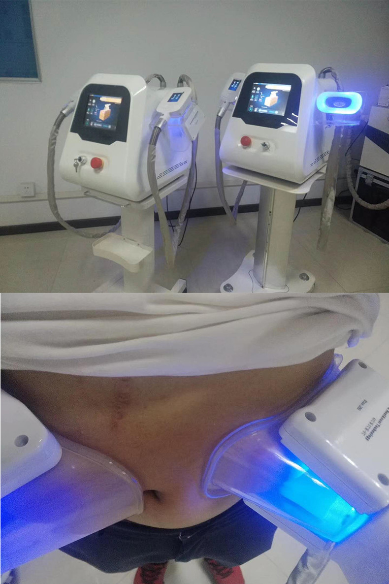 600W Cryolipolysis Fat Freezing Machine For Double Chin Therapy