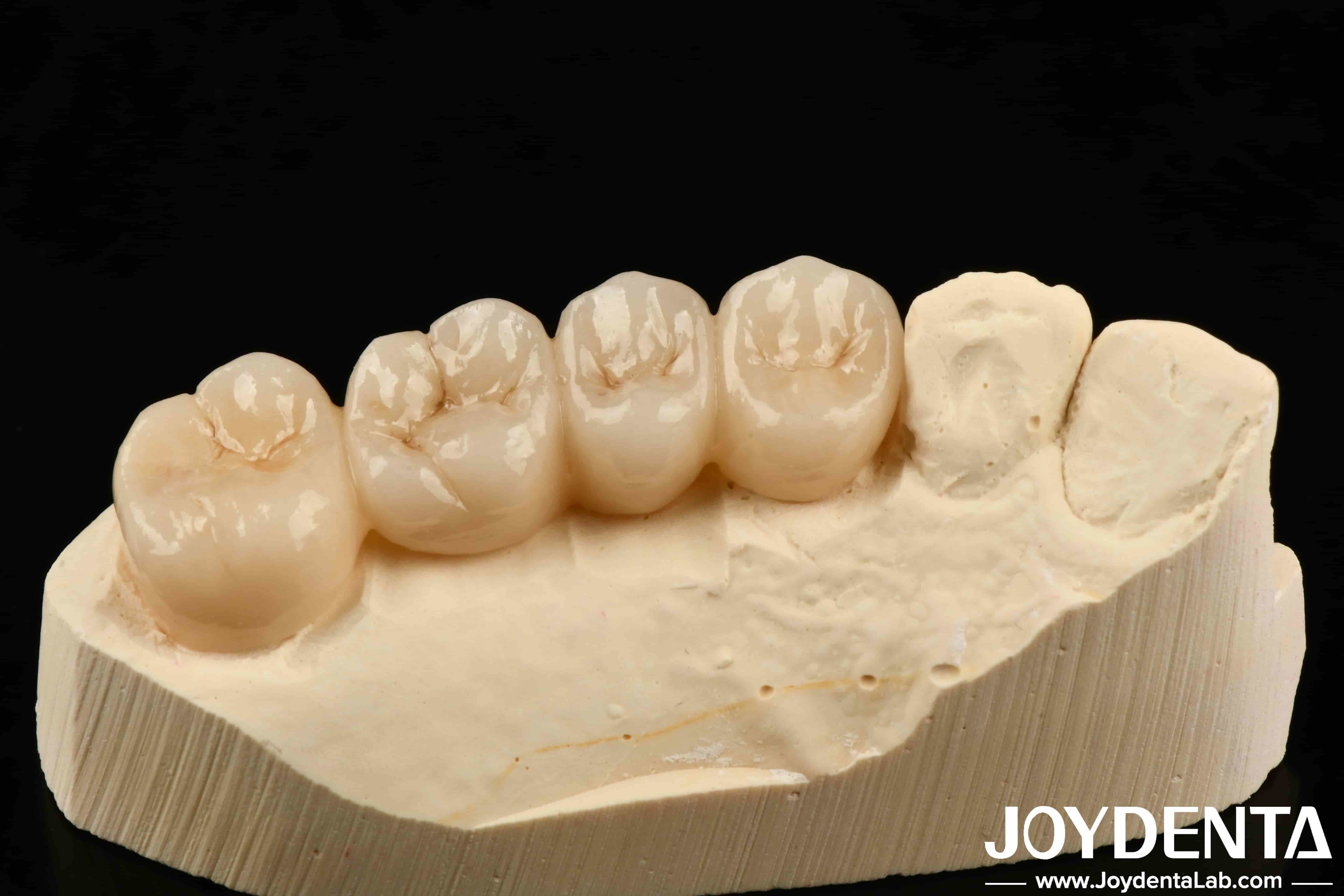 Multilayer Full Zirconia White Style With Layers High Translucency High