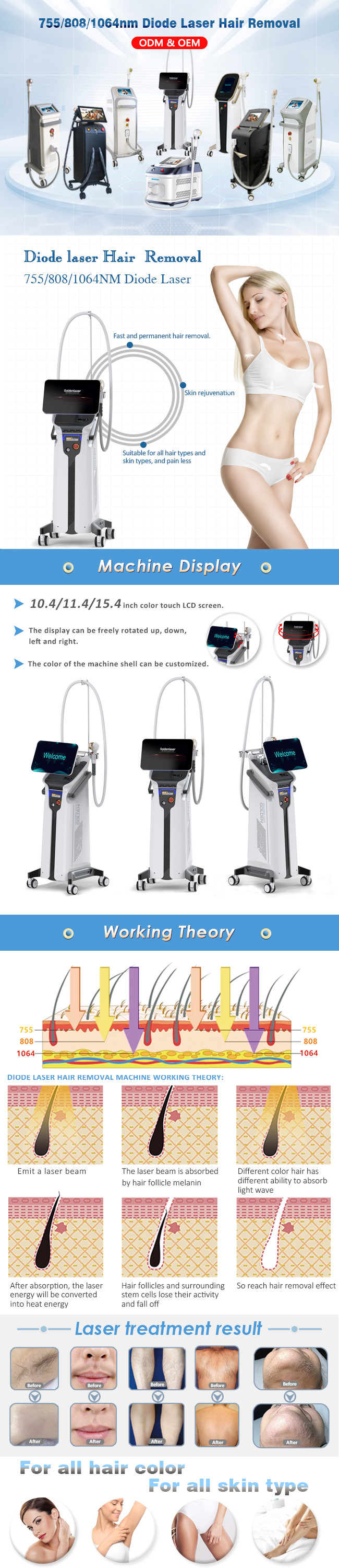12bars 1600watt Triple Wavelength Laser Hair Removal Bikini Area 12 X 36mm2