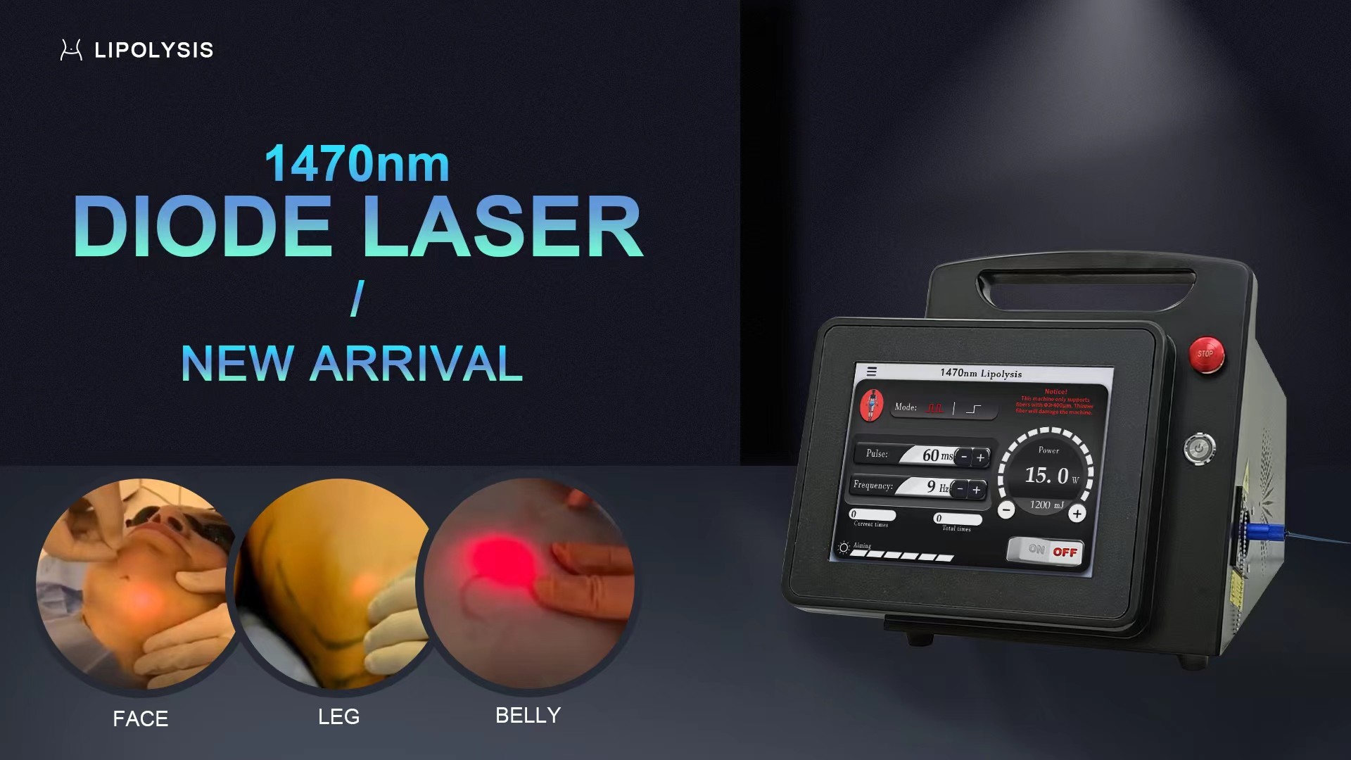 Effective Fat Reduction Treatment Laser Lipolysis Machine With 1470nm Diode Laser Touch Screen Interface Power Up To 30W