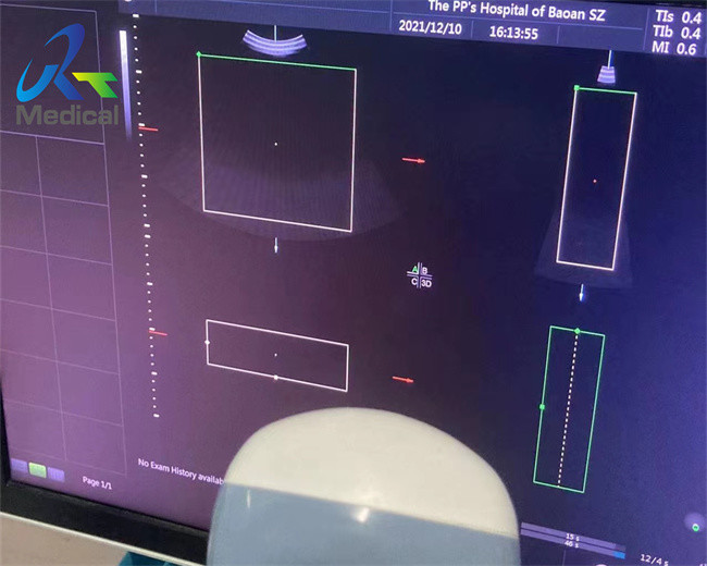GE RM6C 4d Probe Repair Motor Control Failures