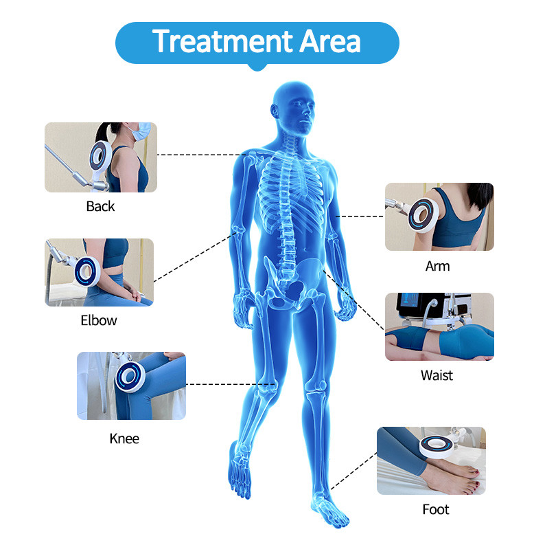 Electromagnetic Therapy Machine For Shoulder / Hip / Knee / Ankle Joint Pain Relief