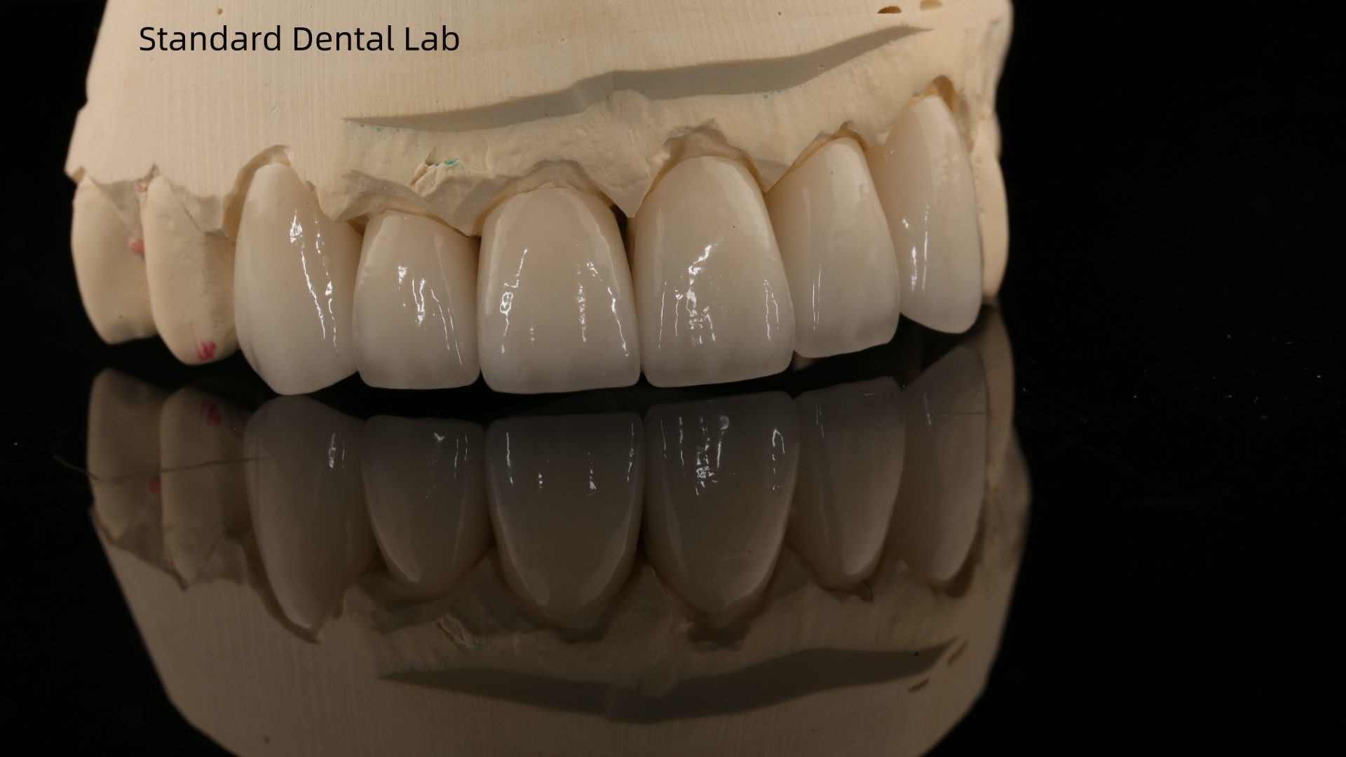 High Quality Dental zirconia crown and All On Four Six Implant Full Arch / China dental lab Manufacturer