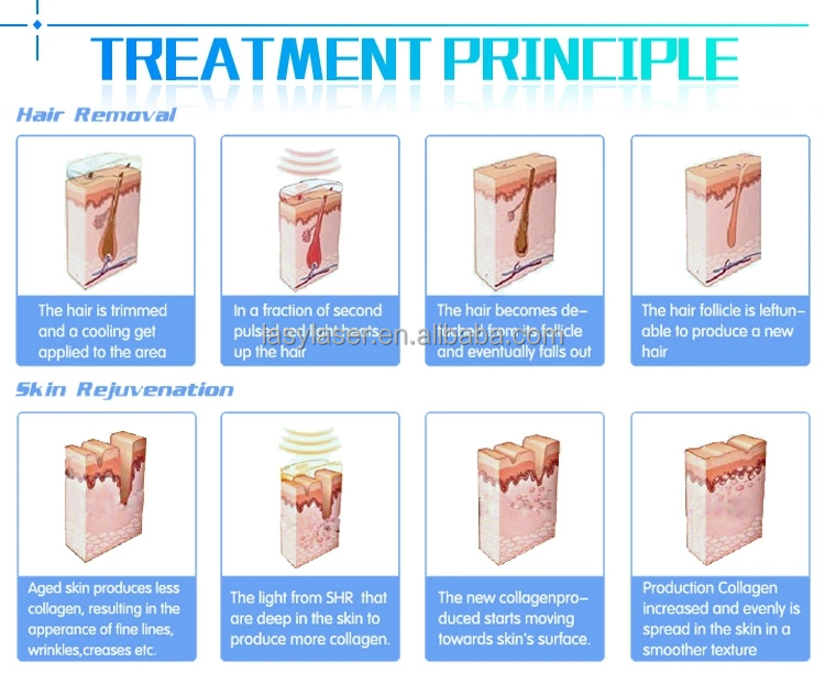 110-240v Professional IPL Laser Hair Removal Machine SHR Freckle Removal