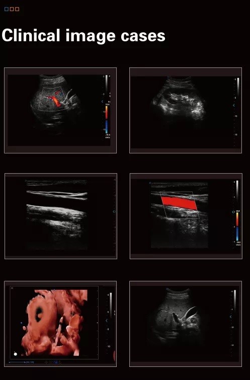 Notebook Black And White Ultrasound Scanner for Cardiology