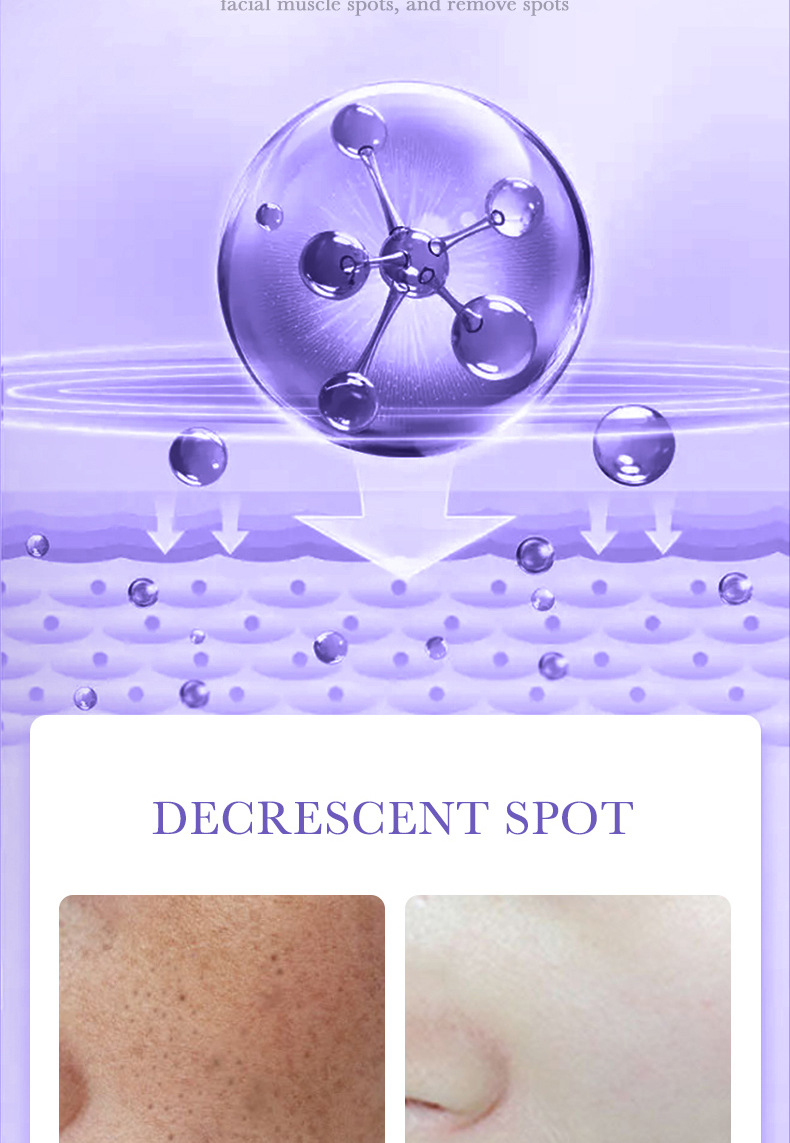 30ml Essence Face Serum 100% Pure Redness Radiant Skin Advanced Rosacea 0