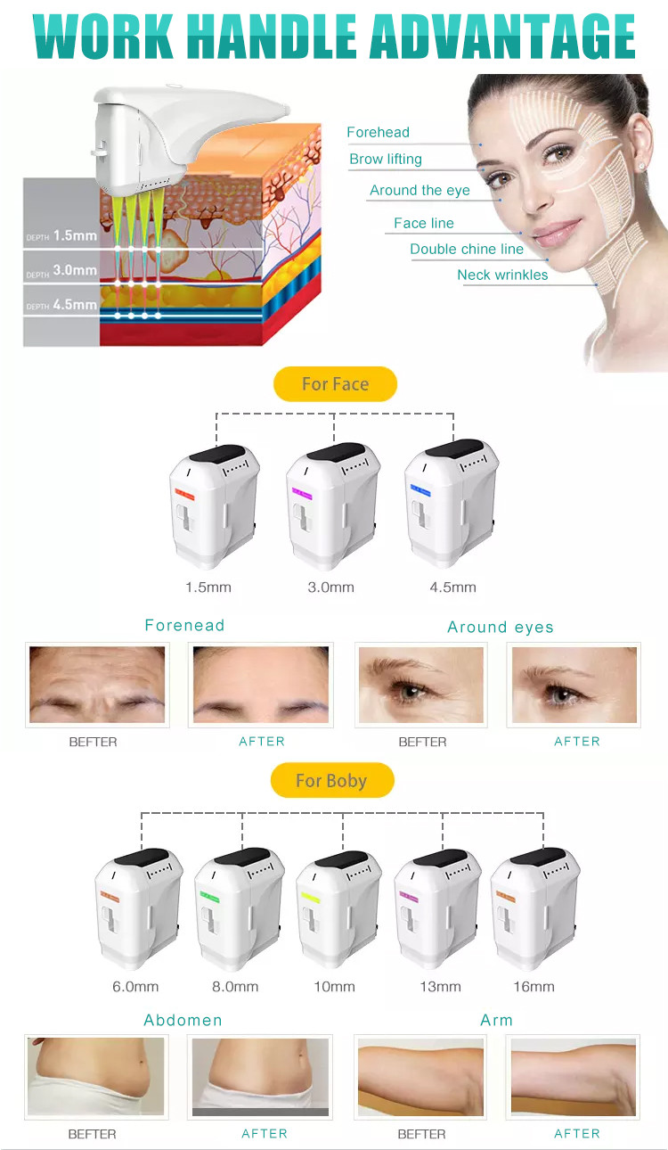 GOMECY 12 Lines 8 Cartridges 4D Hifu Face Lifting Machine Skin Tightening