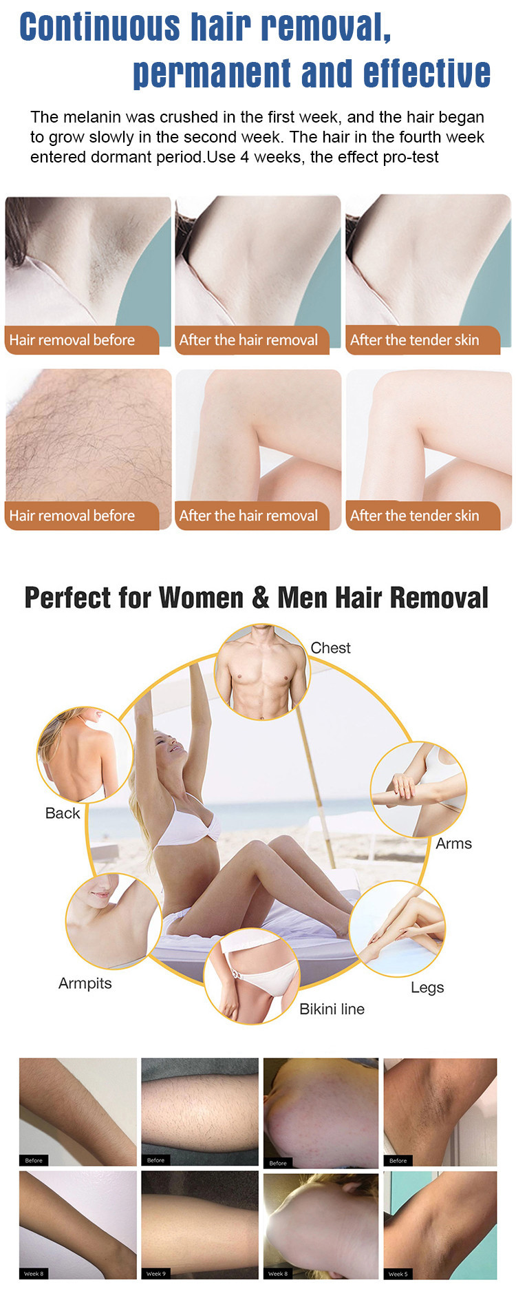 OPT SHR Hair Removal Skin Rejuvenation Beauty Machine Permanent Painless