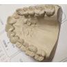 Buy cheap Metal Ceramic Good Fitness PFM Dental Crown from wholesalers