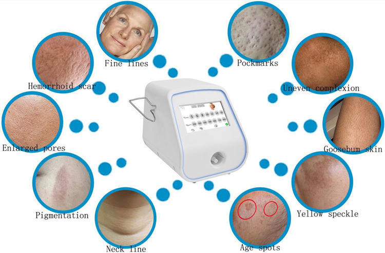 50000 Shots RF Microneedling Machine Pigment Removal CE ISO Approval
