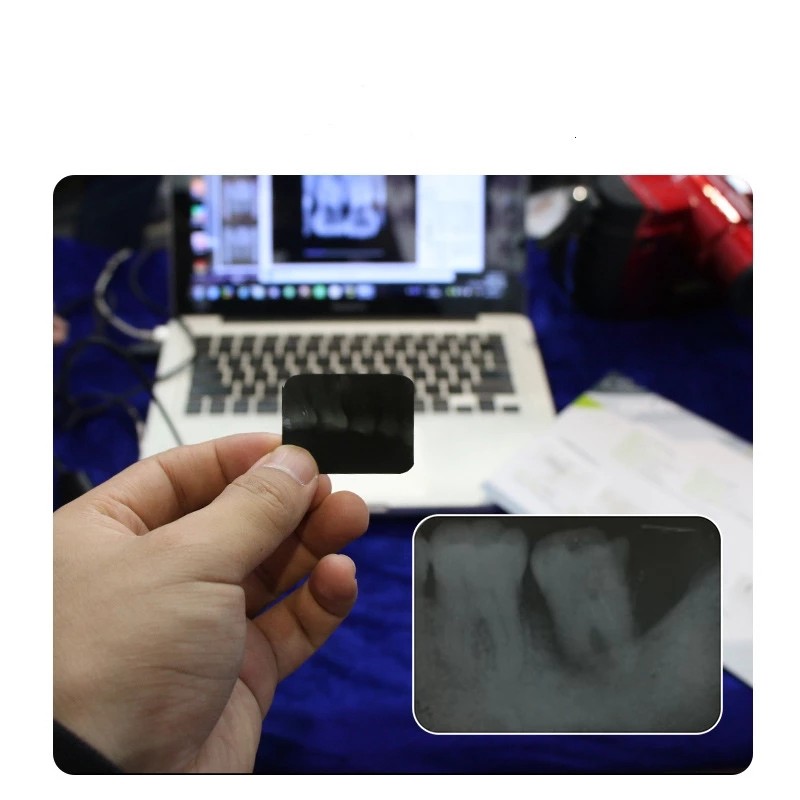 BLX-8 plus High-frequency Digital wireless portable dental x ray machine