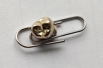 Good Fitness High Precious Gold Alloy Dental Crown