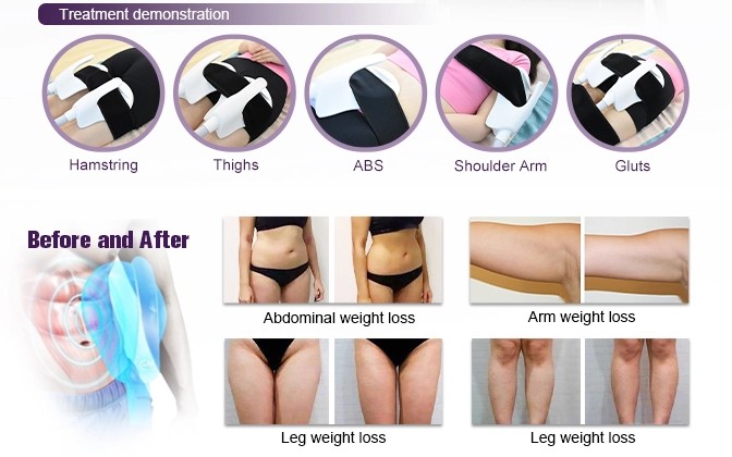Therapy EMS Electronic Muscle Building Machine Body Sculpting ABS White Color