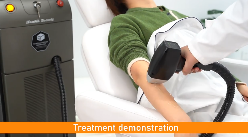 3 Wave Length Laser Hair Removal Machine 808nm 1064nm 755nm for Women Permanent Beauty
