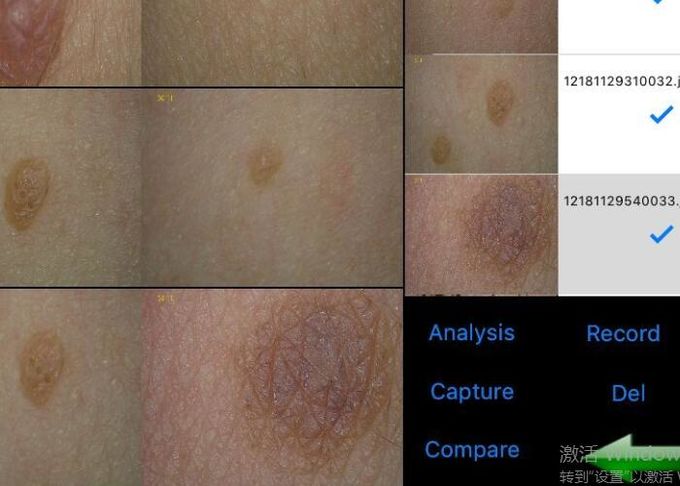 Facial Skin Analysis Equipment Built - In LED Light Source 4 Or 9 Images Displaying