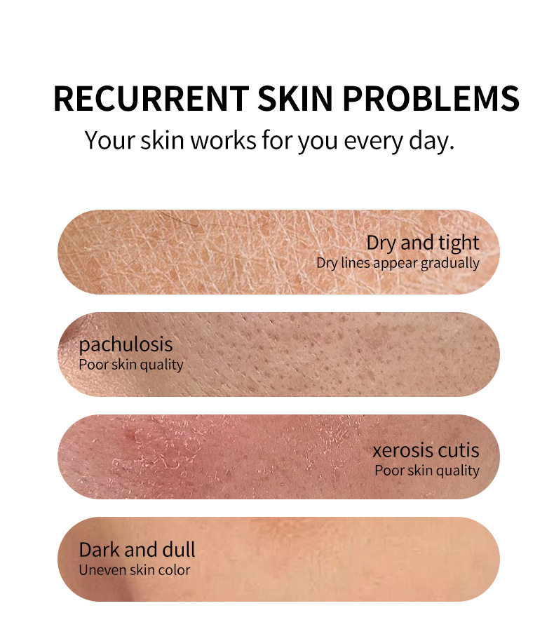 Best Vitamin C Turmeric Whitening Moisturizing Essence Water Shrinking Pores Removing Necrotic Cutin Facial Toner