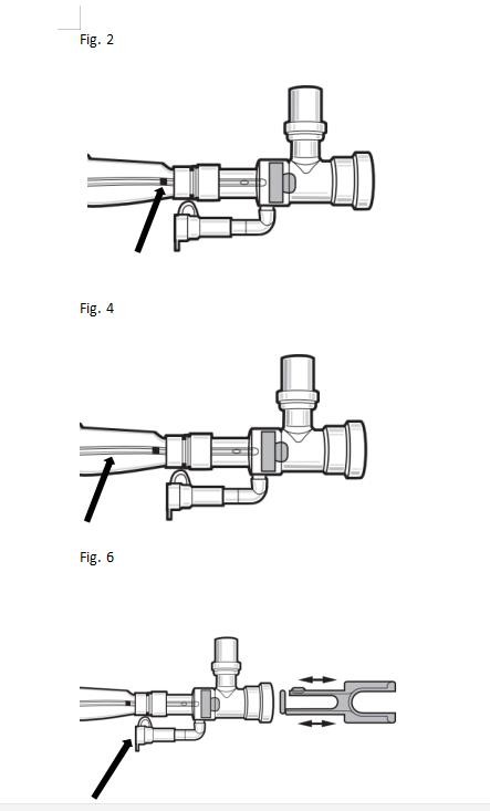 12Fr Endotracheal Closed Suction Catheter
