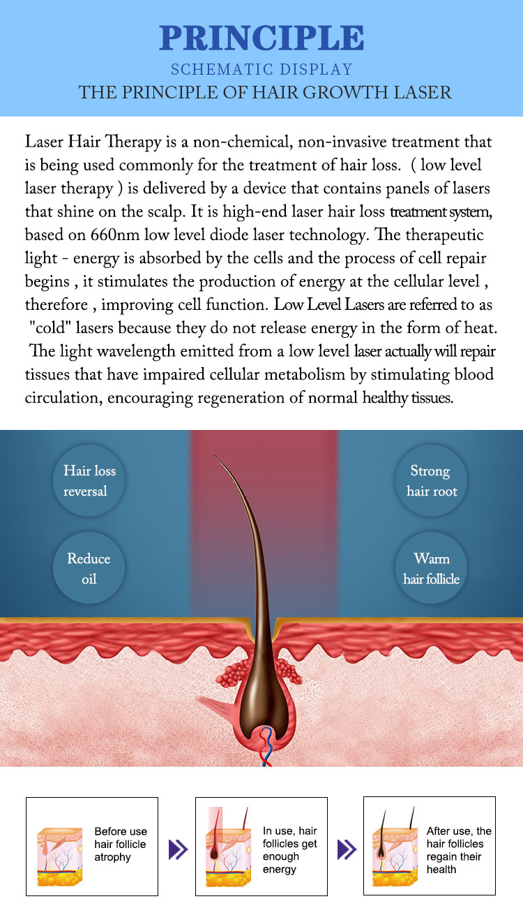 660nm Diode Laser Hair Growth Device For Hair Regeneration / Scalp Nourishment