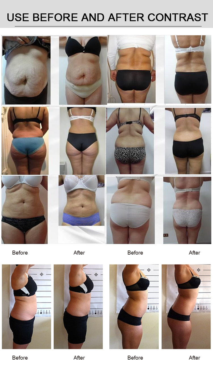 Four Wavelength Diode Zero Laser Lipo Laser Therapy Machines 12 Pads Slimming Beauty Machine