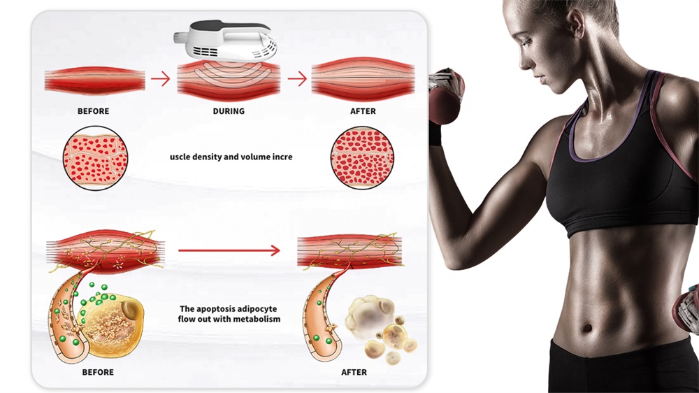 Vertical Ems 2 Handles Body Sculpting Muscle Building RF Slimming Machine