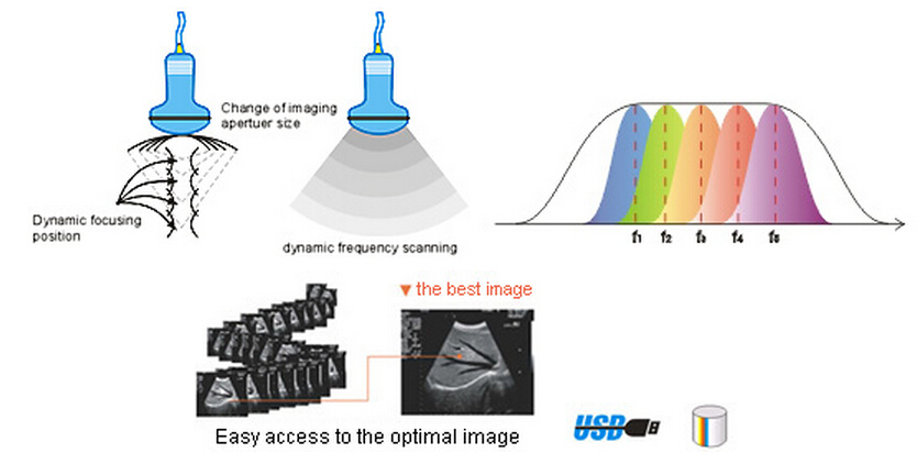 Palm Ultrasound ScannerSU-V5(ultrasonic,black white,Imaging System)