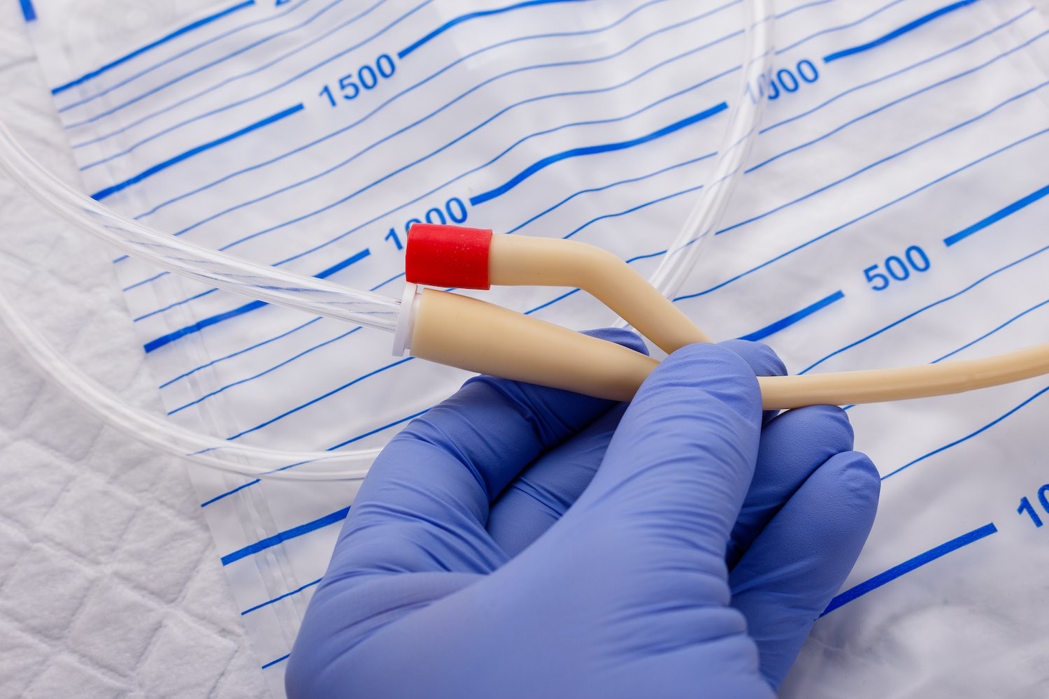 Orcl Male Child External Sterile Latex Foley Balloon Catheter 2 Way 3 Way