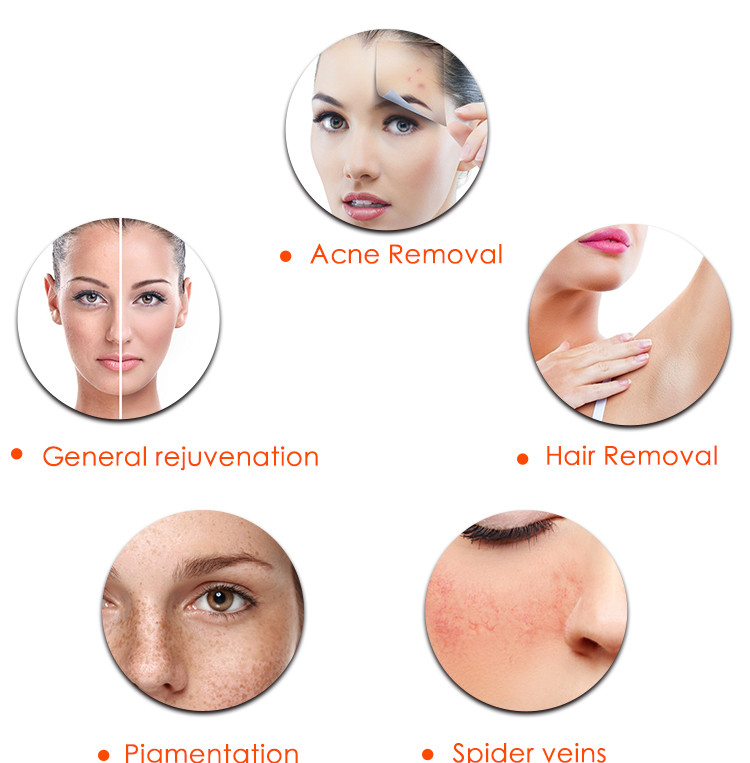 Vertical Q Switched IPL Laser FRACTIONAL RF 3 In 1 Multifunction Beauty Machine