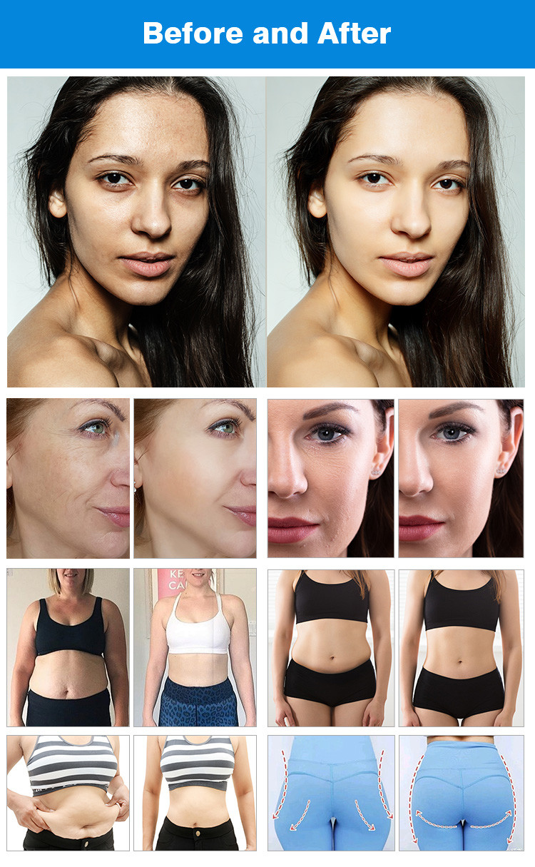 12.1 Inch Screen Postpartum Recovery Machine For Contouring / Skin Rejuvenation